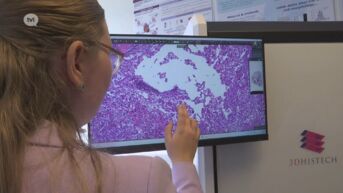 Artificiële intelligentie helpt ziekenhuizen Jessa en ZOL om kanker sneller en efficiënter op te sporen
