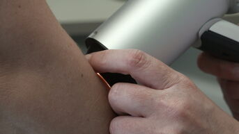Superscanner in Hasselt spoort huidkanker op met AI-technologie