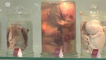 Lichaamsdelen en organen tentoongesteld op bijzondere expo in UHasselt