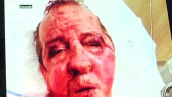 Chauffeur van Hasselts taxibedrijf in mekaar geslagen in Brussel