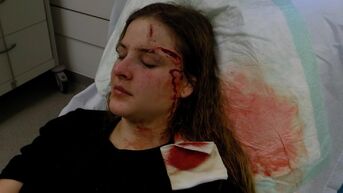 Jonge vrouw verwond met stuk glas op Dusartplein